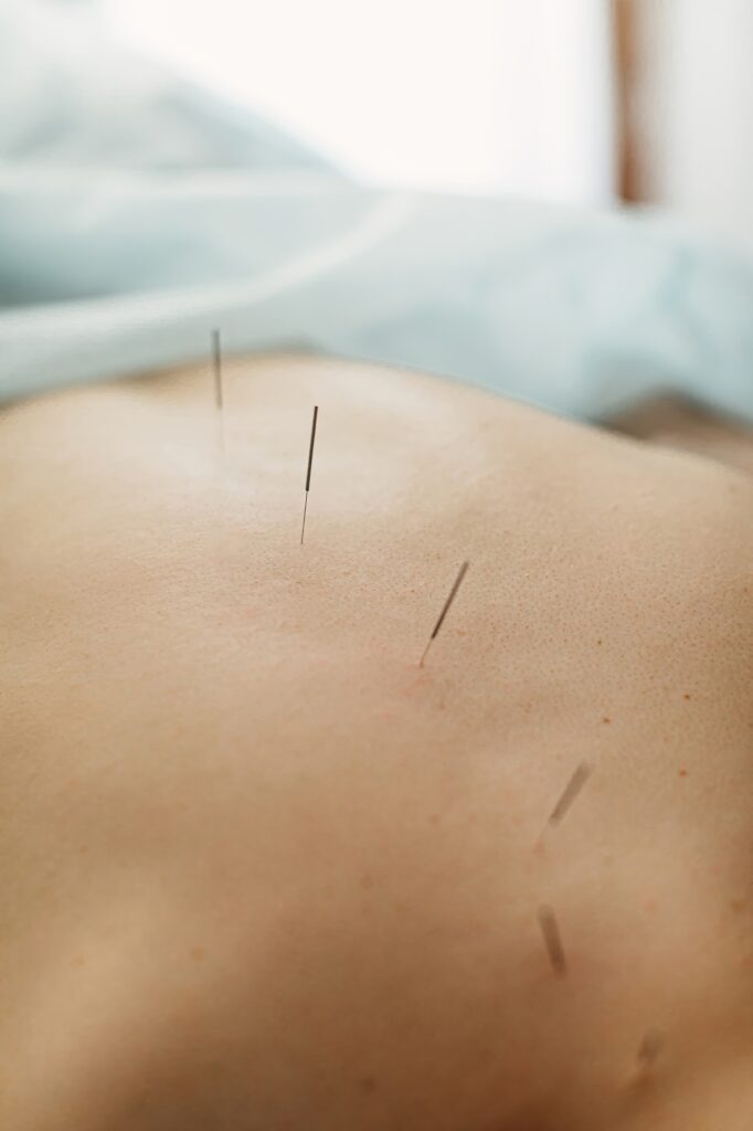 Woman stabbed in the back with needle in bright acupuncture clinic